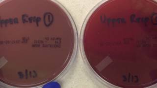 Plate Reading  Upper Respiratory I [upl. by Aseram977]