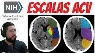 📎 Escala de NIHSS y ASPECTS para abordaje de ACCIDENTE CEREBROVASCULAR ✍🏻🧠 [upl. by Atinwahs]