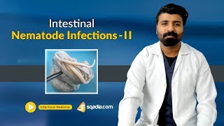 Intestinal Nematode Infections II  Medicine Lectures  Medical Education  VLearning [upl. by Edson]