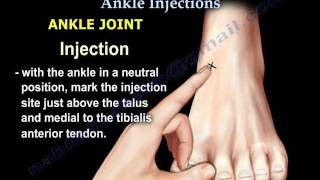 Common Foot And Ankle Injections  Everything You Need To Know  Dr Nabil Ebraheim [upl. by Brenza384]