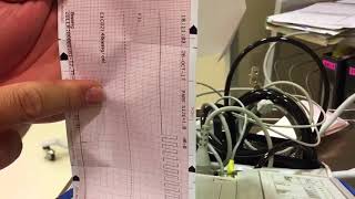 Defibrillator Check For Crash Carts— Zoll ARMC hd [upl. by Innad]