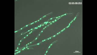 Nuclear distribution in filamentous fungi [upl. by Higinbotham327]