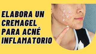 Cremagel antiacné con clindamicina e indometacina [upl. by Osicran671]