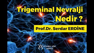 Trigeminal Nevralji Nedir [upl. by Ahsinroc946]