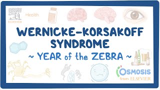 Wernicke Korsakoff Syndrome Year of the Zebra [upl. by Anavoj50]