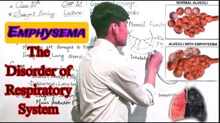 Emphysema  The disorder of Respiratory System Class 10th Biology [upl. by Robyn154]