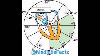 EKG basics  What is sinus rhythm doctor [upl. by Thissa517]