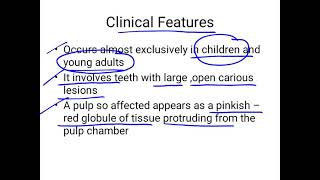 chronic hyperplastic pulpitis [upl. by Nosilla]