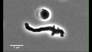 Cholera bacteria reawakening after antibiotic exposure [upl. by Ennylhsa]