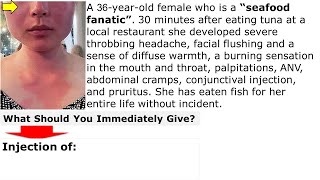 Reaction after eating fish What is your treatment Q CME internalmedicine محاضراتباطنة [upl. by Dugas]