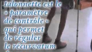 Equin du pied  recurvatum douloureux Traitement  talonnette 44582 [upl. by Jamill677]