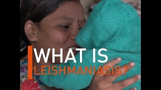 What is Leishmaniasis [upl. by Serafina]