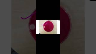 Blood agar microbiology bloodagar microbiology alphahaemolytic betahaemolytic [upl. by Blank593]