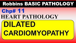 Chp11 Robbins Patho  Heart Pathology  DILATED Cardiomyopathy  Dr Asif Lectures [upl. by Walden]