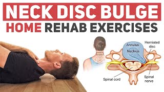 Neck Disc BulgeHerniation Rehab Exercises [upl. by Paulita]