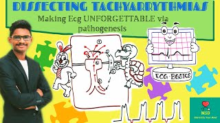 ECG Basics  Making Tachyarrhythmias Unforgettable Via Dissecting its Pathogenesis NEETPGINICET [upl. by Niriam]