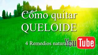 4 REMEDIOS NATURALES para QUITAR QUELOIDE [upl. by Toffey]