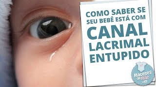 CANAL LACRIMAL ENTUPIDO E COMO TRATAR A OBSTRUÇÃO  MACETES DE MÃE [upl. by Ainer]