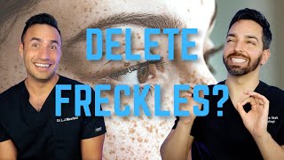 Freckles Does SPF and Retinol Fade Them [upl. by Domonic570]