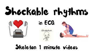 Shockable rhythms in ECG in 1 min  Skeleton ACLS shorts [upl. by Catina]