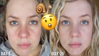 I Used SNAIL Skincare for 21 Days the results shocked me [upl. by Ardys]