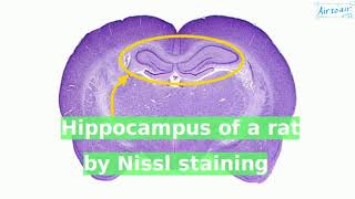 Nissl staining [upl. by Anitsahs]