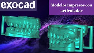 Modelos con articulador para imprimir 3D en exocad🚀🌀 [upl. by Terrance]