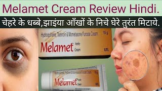 Melamet Cream ke Fayde Melamet Cream ki Jankari Melamet Cream Uses in Hindi [upl. by Anitsugua237]