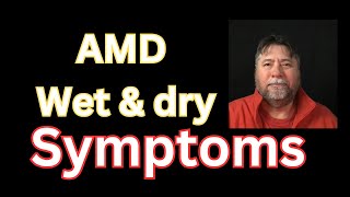 😎 Macular Degeneration Symptoms AMD Wetb amp Dry [upl. by Hiram]