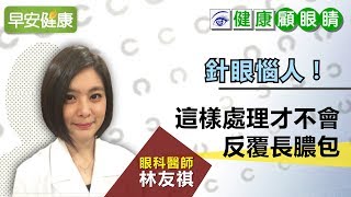 針眼惱人！眼科醫師：這樣處理才不會反覆長膿包【眼科醫師 林友祺／健康顧眼睛】 [upl. by Omlesna]