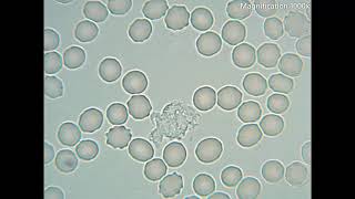 White Blood Cells Crawling Under The Microscope  1000x magnification [upl. by Niriam]