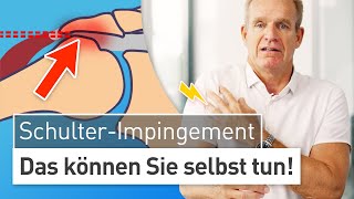 Impingement Syndrom ohne OP behandeln Schulterschmerzen loswerden [upl. by Florance]