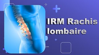 IRM du Rachis lombaire Bonne Pratique [upl. by Aelaza]