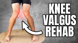 Knock Knees Correction Knee Valgus Exercises [upl. by Leiba731]