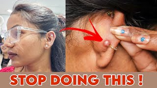 STOP getting EarNose Piercing Infection Again  100 Result  Ravinaa Gupta [upl. by Eelana]