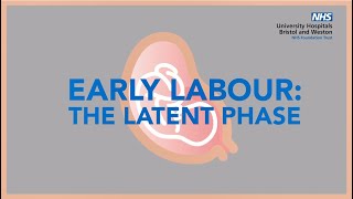 Early Labour  The Latent Phase [upl. by Pine709]