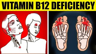 Vitamin B12 Deficiency Symptoms That Should Never Be Ignored [upl. by Ahsahtan916]