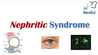 Nephritic Syndrome  Clinical Presentation Causes and Treatment [upl. by Nyvlem]