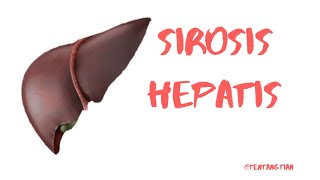 SIROSIS HEPATIS  SIROSIS HATI  WASPADA SIROSIS HATI CIRRHOSIS SIROSISHATI SIROSIS PATOLOGI [upl. by Ailegna]