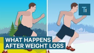 What Losing Weight Does To Your Body And Brain  The Human Body [upl. by Diamond]