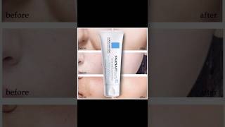 Viral Skincare Tested Is Cicaplast Balm Worth the Hype  Doctorly Reviews [upl. by Akayas921]