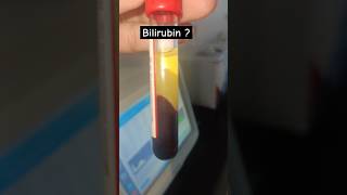 Bilirubin kitna hailab technologist status labstatus shorts pathology bloodtest scienceaiims [upl. by Valerlan]