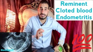 Level 3  Female pelvis  Obs  Emergency  Post abortion Reminent vs cloted blood [upl. by Nodab]