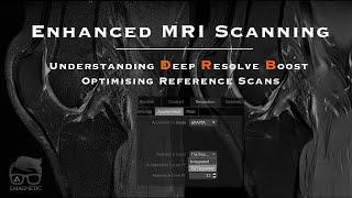 Enhanced MRI Scanning Understanding Deep Resolve Boost and Optimizing Reference Scans [upl. by Briant]