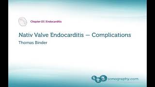 Native Valve Infective Endocarditis Complications with Echocardiography Examples pseudoaneurysm etc [upl. by Hermine]