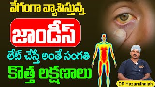 Jaundice Symptoms  జాండీస్ లక్షణాలు  DRHazarathaiah  SumanTV Max [upl. by Oster974]