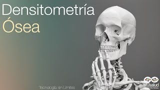 Densitometria óssea  Como Interpretar [upl. by Yenttirb]