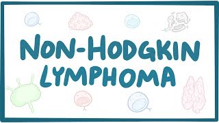 Nonhodgkin lymphoma  causes symptoms diagnosis treatment pathology [upl. by Marla]