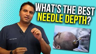 Dermarolling Optimal Needle Depth  The Hair Loss Show [upl. by Anastase]