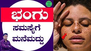 Bhangu Mane Maddu  Bhangu Nivarane  Bangu treatment Kannada  pigmentation kannada Shorts [upl. by Navets6]